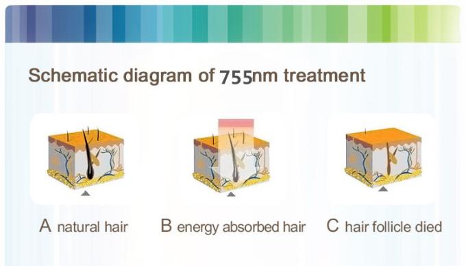 755nm Alexandrite Laser Hair Removal For Tiny Hair Permanently Removal CE ISO