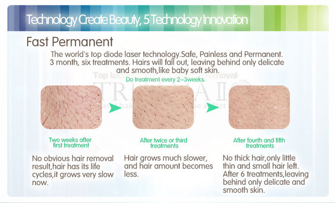 Promotion Body Pain Free Laser Hair Removal Machines For Salon