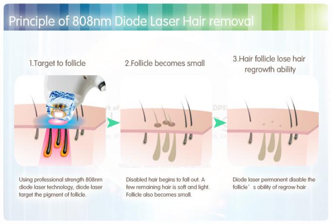 Full Body 810nm Diode Laser Hair Removal Machine For Beauty Equipment
