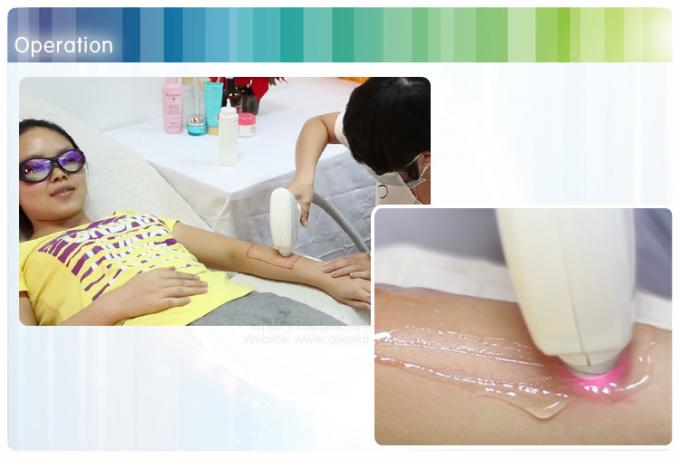 Custom 808nm Diode Laser Hair Removal Machine For Salon 60cm * 60cm * 66cm