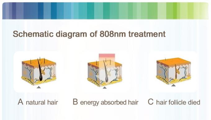 400W Desk-top 808nm Laser Hair Removal Equipment with Multifunction of Skin Rejuvenation