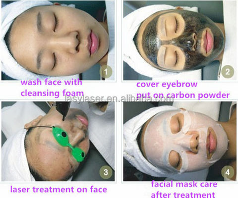 1064nm Carbon Laser Cream Nd Yag Laser Peeling Beauty Machine Accessories