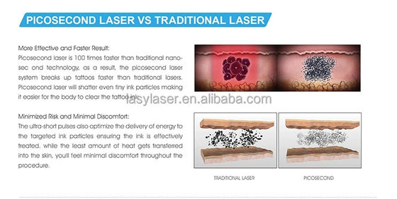0.7-0.8mm Picosecond Laser Tattoo Removal Machine Nd Yag Hydrodermabrasion