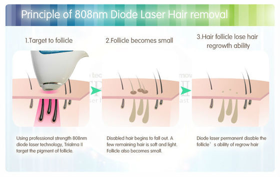 808nm Diode LED Skin Rejuvenation Machine 220v Yag Laser Hair Removal